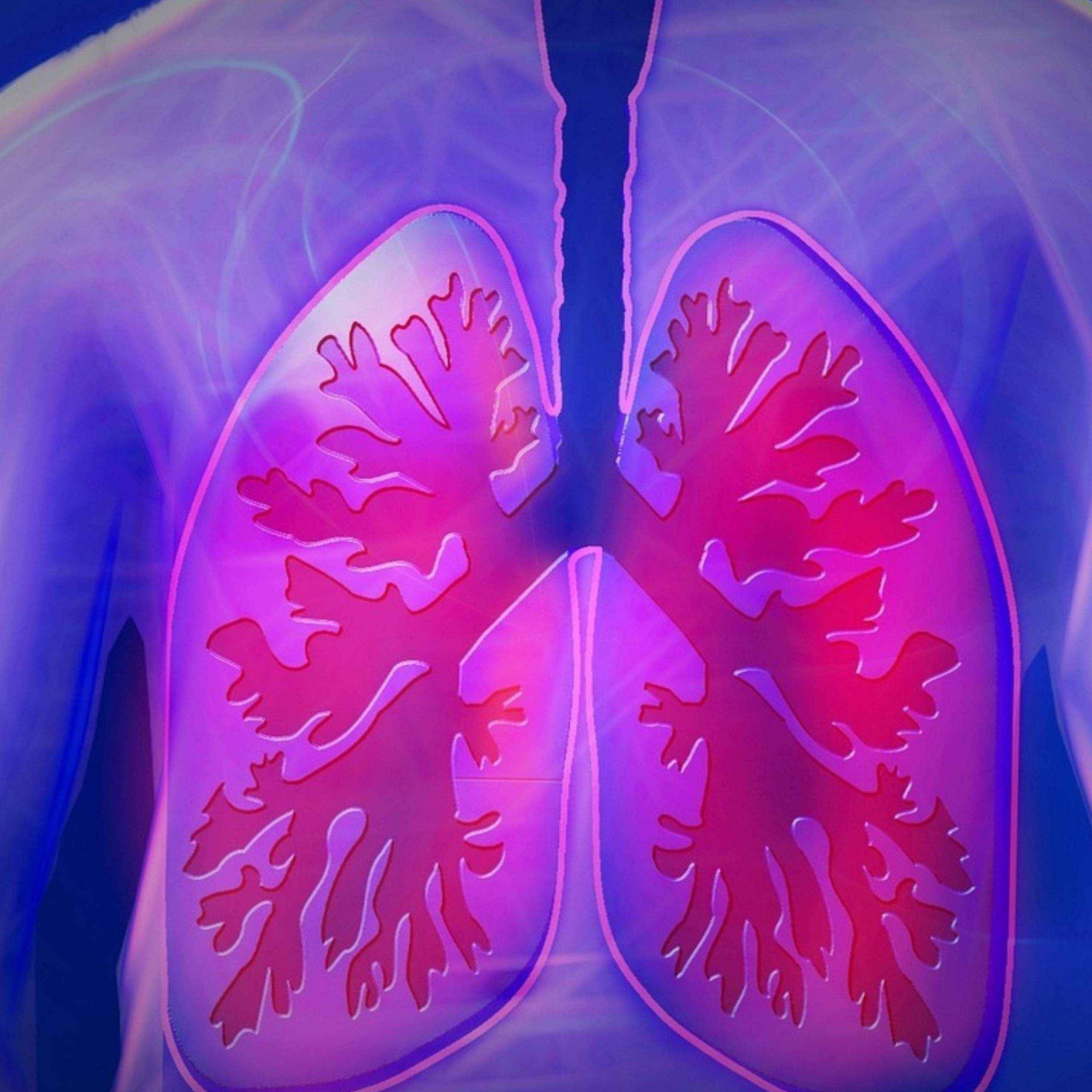 Suporte Pulmonar